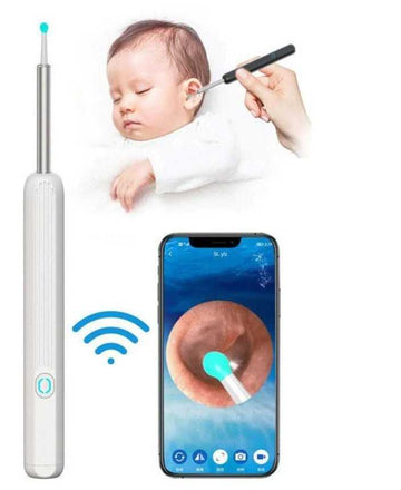 Earwax Removal with HD Camera